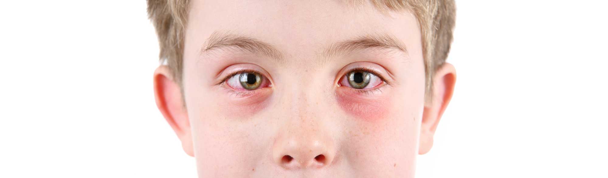 slideemergencycare Dominion Eye Care